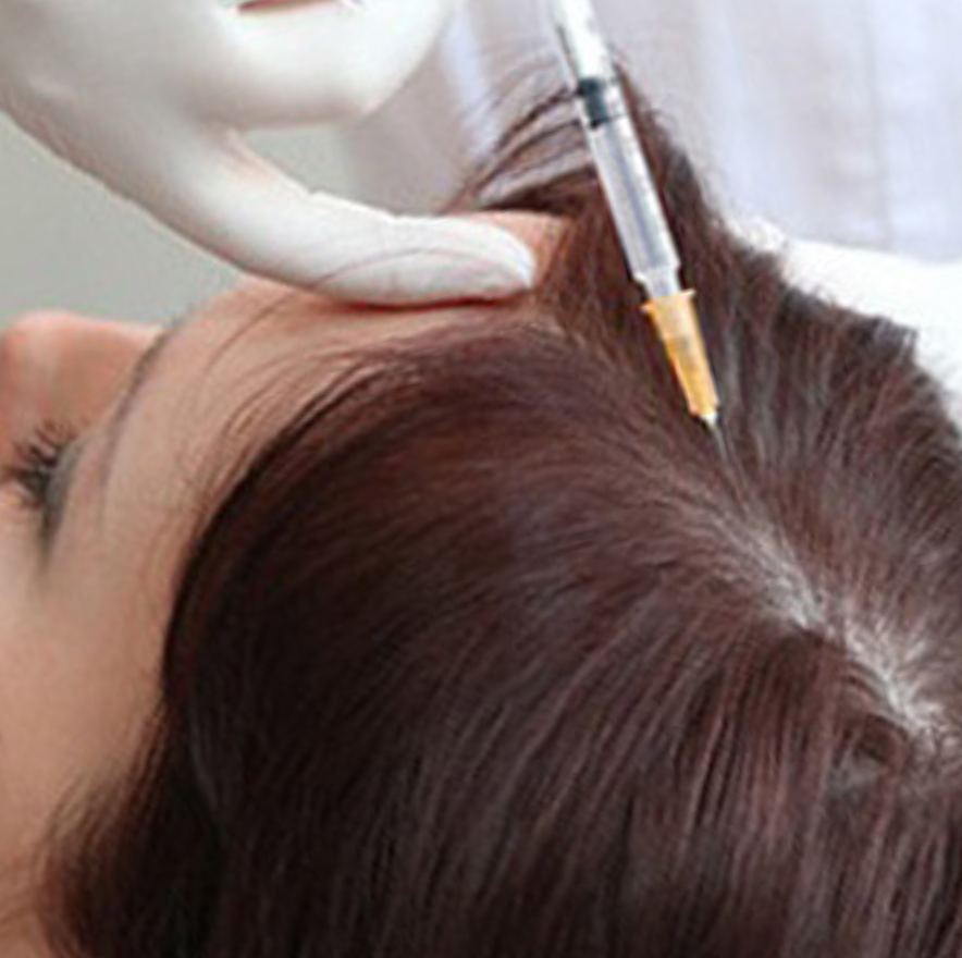3 Мезотерапия для волос в салоне красоты На Речной в Красногорске