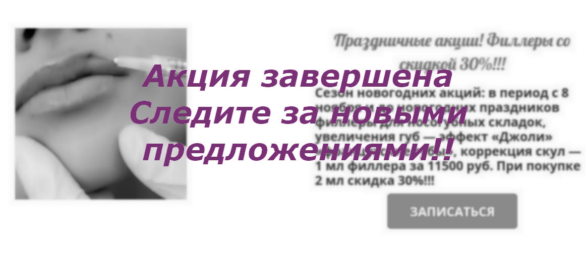 Анонс о завершении новогодней акции в салоне красоты На Речной в Красногорске, 20.02.2020, филлер для губ со скидкой