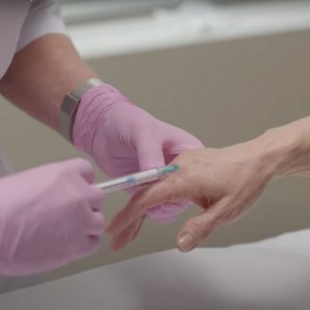 Мезотерапия для кожи рук в салоне красоты На Речной в Красногорске
