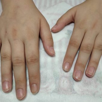 Общий вид рук после выполненного маникюра, ногти подготовлены к наращиванию, салон красоты На Речной в Красногорске